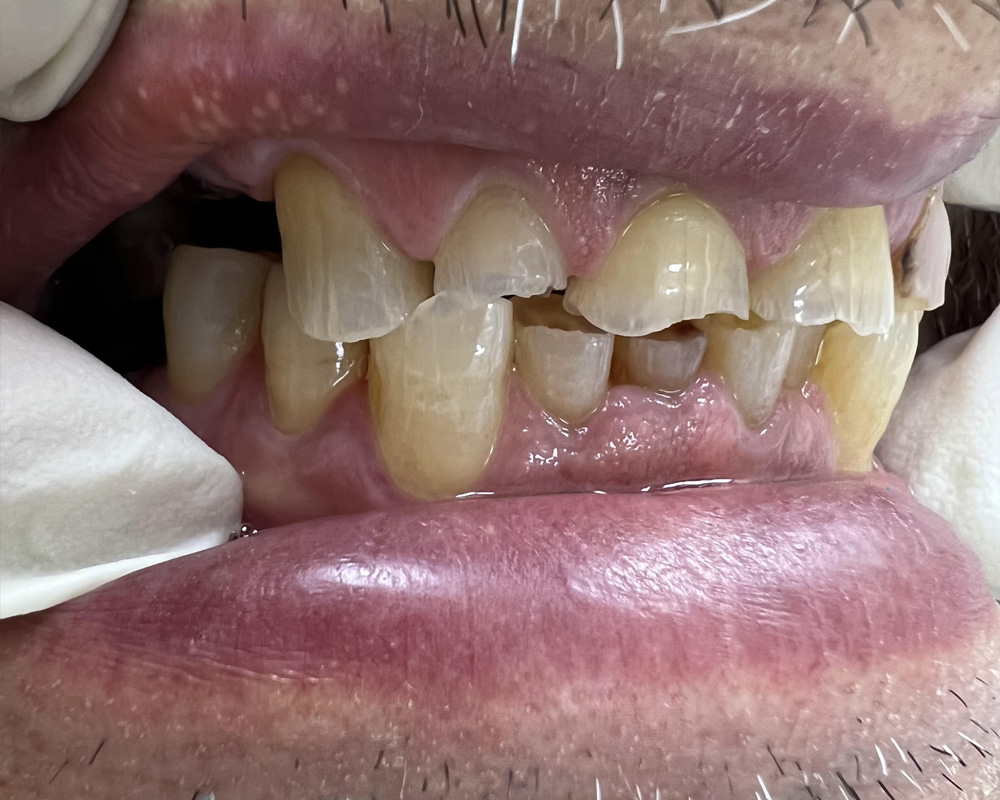 Pre-treatment — Initial consultation